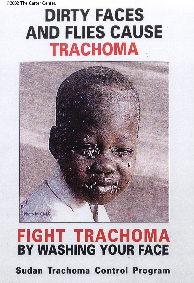 eye with trachoma
