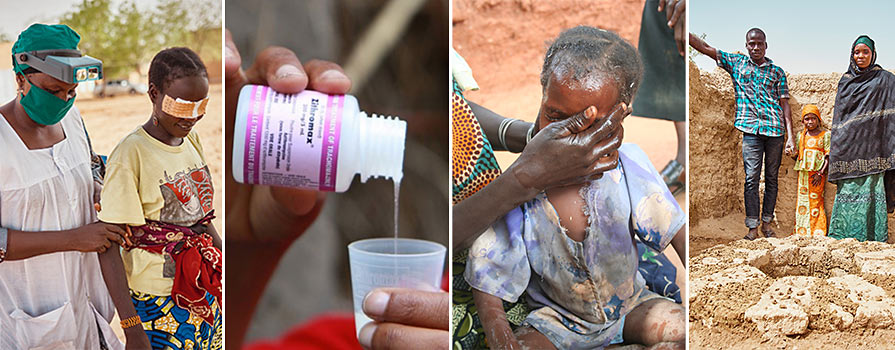 Images of the SAFE strategy to fight trachoma.