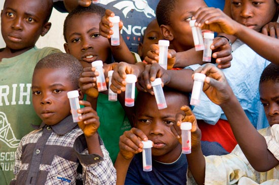 Children infected with schistosomiasis show vials of blood-red urine.