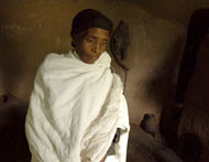 Photo of trachoma victim Yengussie Tebeje